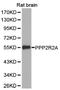 Serine/threonine-protein phosphatase 2A 55 kDa regulatory subunit B alpha isoform antibody, LS-C193096, Lifespan Biosciences, Western Blot image 