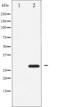 Activating Transcription Factor 1 antibody, abx010427, Abbexa, Western Blot image 