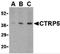 C1q And TNF Related 5 antibody, 3573, ProSci, Western Blot image 