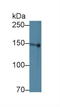 LDL Receptor Related Protein 8 antibody, LS-C295198, Lifespan Biosciences, Western Blot image 