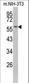 Keratin 14 antibody, LS-C165617, Lifespan Biosciences, Western Blot image 