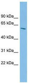 Inositol-Pentakisphosphate 2-Kinase antibody, TA344670, Origene, Western Blot image 