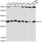 Enoyl-CoA Hydratase 1 antibody, A12944, ABclonal Technology, Western Blot image 