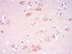 Pyruvate Dehydrogenase Kinase 1 antibody, ab110025, Abcam, Immunohistochemistry paraffin image 