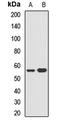 5-Hydroxytryptamine Receptor 3A antibody, LS-C667669, Lifespan Biosciences, Western Blot image 