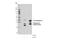 Cathepsin B antibody, 31718S, Cell Signaling Technology, Western Blot image 