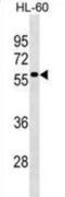 Zinc Finger And BTB Domain Containing 22 antibody, abx029547, Abbexa, Western Blot image 