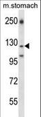 Laminin Subunit Gamma 2 antibody, LS-C165673, Lifespan Biosciences, Western Blot image 