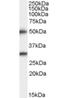 Transmembrane Serine Protease 5 antibody, orb18346, Biorbyt, Western Blot image 