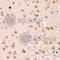 Inhibitor Of Nuclear Factor Kappa B Kinase Subunit Beta antibody, A2087, ABclonal Technology, Immunohistochemistry paraffin image 