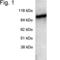 Phosphodiesterase 6A, cGMP-specific, rod, alpha antibody, PA1-720, Invitrogen Antibodies, Western Blot image 