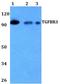 Transforming Growth Factor Beta Receptor 3 antibody, GTX66788, GeneTex, Western Blot image 