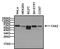 Checkpoint Kinase 2 antibody, MA5-15416, Invitrogen Antibodies, Western Blot image 