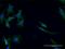 Glutamic--Pyruvic Transaminase 2 antibody, H00084706-M04, Novus Biologicals, Immunocytochemistry image 