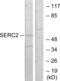 Serine Incorporator 2 antibody, abx013766, Abbexa, Western Blot image 