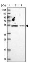 Zinc Finger Protein 322 antibody, PA5-60262, Invitrogen Antibodies, Western Blot image 