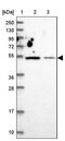 Zinc finger protein 322A antibody, PA5-60262, Invitrogen Antibodies, Western Blot image 