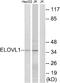 ELOVL Fatty Acid Elongase 1 antibody, A30088, Boster Biological Technology, Western Blot image 