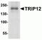 Probable E3 ubiquitin-protein ligase TRIP12 antibody, NBP2-81864, Novus Biologicals, Western Blot image 