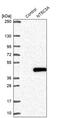 5'-Nucleotidase, Cytosolic IIIA antibody, PA5-52714, Invitrogen Antibodies, Western Blot image 