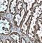 MAPK 1 antibody, FNab02847, FineTest, Immunohistochemistry paraffin image 