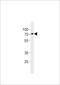 Suppression Of Tumorigenicity 7 Like antibody, A12750, Boster Biological Technology, Western Blot image 