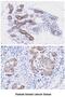Peptidylprolyl Isomerase F antibody, MBS200138, MyBioSource, Immunohistochemistry paraffin image 
