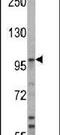 Ubiquitin Protein Ligase E3A antibody, PA5-12038, Invitrogen Antibodies, Western Blot image 