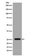 Glutathione S-Transferase Pi 1 antibody, M00394, Boster Biological Technology, Western Blot image 