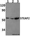STEAP2 Metalloreductase antibody, A08410-1, Boster Biological Technology, Western Blot image 