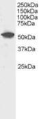 Dual Specificity Phosphatase 10 antibody, MBS420639, MyBioSource, Western Blot image 