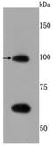 Toll Like Receptor 5 antibody, NBP2-67205, Novus Biologicals, Western Blot image 