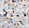 WT1 Transcription Factor antibody, NB110-60011, Novus Biologicals, Immunohistochemistry frozen image 