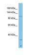 Laminin Subunit Beta 3 antibody, orb330199, Biorbyt, Western Blot image 