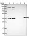 Arylsulfatase Family Member K antibody, PA5-59964, Invitrogen Antibodies, Western Blot image 