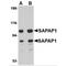 DLG Associated Protein 1 antibody, MBS151337, MyBioSource, Western Blot image 