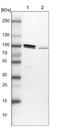 Anaphase Promoting Complex Subunit 5 antibody, NBP1-90136, Novus Biologicals, Western Blot image 