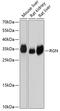 Senescence marker protein 30 antibody, GTX64953, GeneTex, Western Blot image 