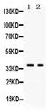 Gal-4 antibody, PB9952, Boster Biological Technology, Western Blot image 