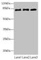 Cytoplasmic Polyadenylation Element Binding Protein 4 antibody, LS-C377410, Lifespan Biosciences, Western Blot image 