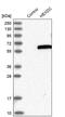 Hexosaminidase D antibody, PA5-54780, Invitrogen Antibodies, Western Blot image 