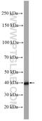 AlkB Homolog 1, Histone H2A Dioxygenase antibody, 27973-1-AP, Proteintech Group, Western Blot image 