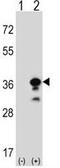 Granzyme B antibody, GTX81831, GeneTex, Western Blot image 