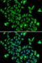 SAM Pointed Domain Containing ETS Transcription Factor antibody, orb373468, Biorbyt, Immunocytochemistry image 