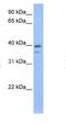 VPS26, Retromer Complex Component B antibody, NBP1-56502, Novus Biologicals, Western Blot image 