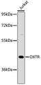 Oxytocin Receptor antibody, 23-879, ProSci, Western Blot image 