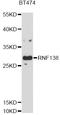 Ring Finger Protein 138 antibody, abx126486, Abbexa, Western Blot image 