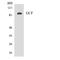  antibody, A30922, Boster Biological Technology, Western Blot image 