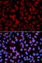 TNF Alpha Induced Protein 3 antibody, STJ25884, St John