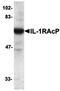 ARC/ARG3.1 antibody, orb74358, Biorbyt, Western Blot image 